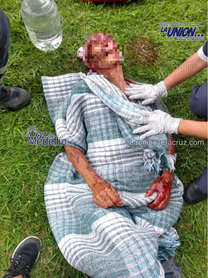 pitbulls atacan a ancianno